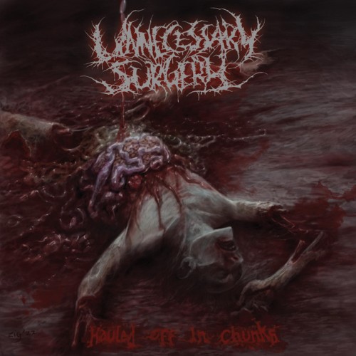 Unnecessary Surgery - Hauled Off in Chunks (2022) Download